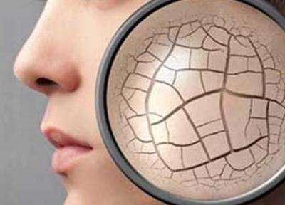 محققان تبریزی ژلی برای بهبود چین و چروک پوست فراوری کردند