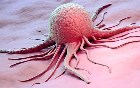 شاید نانوذرات به درمان تومور های سرطانی یاری کند