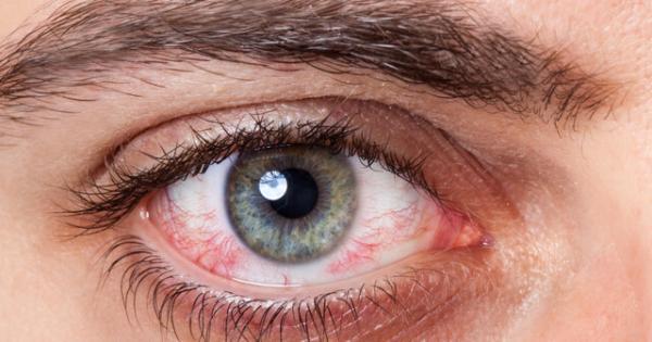 6 عفونت چشمی که می توانند عواقب فاجعه باری داشته باشند